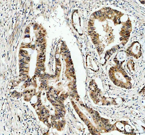 a05408 3 gtf2h1 primary antibodies ihc testing 1