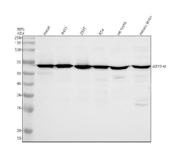 a05408 3 gtf2h1 primary antibodies wb testing 1
