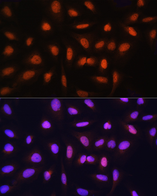 Immunofluorescence analysis of U-2 OS cells using GTF2H1 Rabbit pAb  at dilution of 1:100 