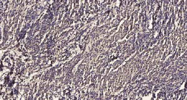 Immunohistochemical analysis of paraffin-embedded human meningioma