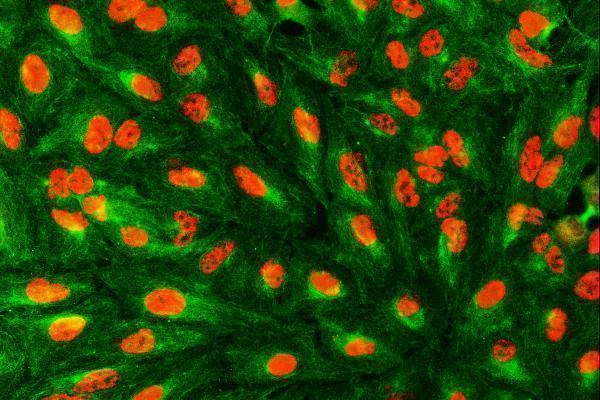 a05414 1 sart1 primary antibodies if testing 7
