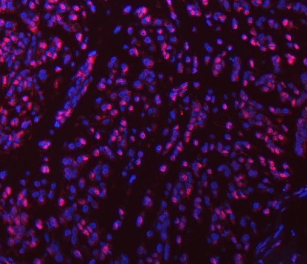 a05414 1 sart1 primary antibodies if testing 8