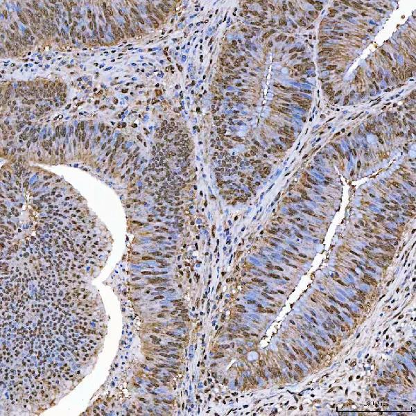  IHC analysis of SART1 using anti-SART1 antibody (A05414-1)