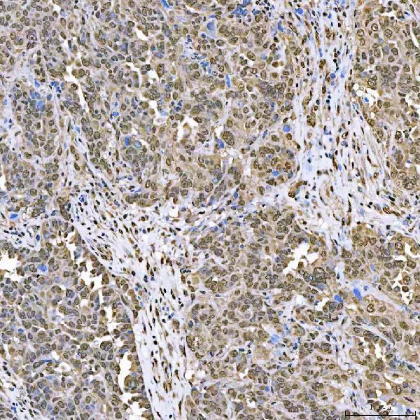 IHC analysis of SART1 using anti-SART1 antibody (A05414-1)