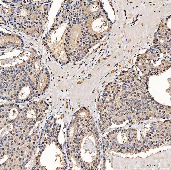 a05414 1 sart1 primary antibodies ihc testing 4