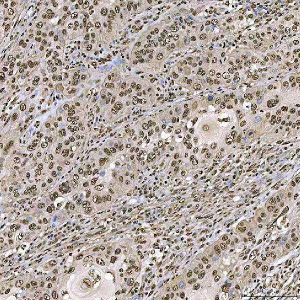 a05414 1 sart1 primary antibodies ihc testing 5