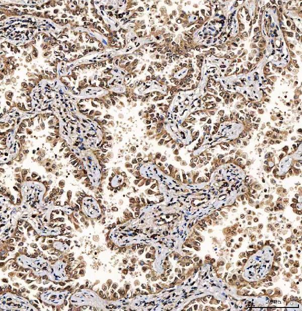 a05414 1 sart1 primary antibodies ihc testing 6