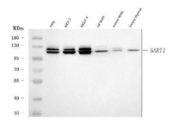  Western blot analysis of SART1 using anti-SART1 antibody (A05414-1)