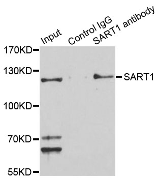 a05414 sart1 primary antiboties ihc testing 2