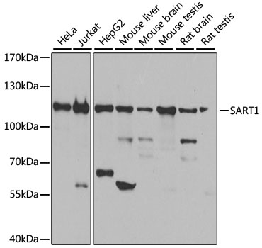 a05414 sart1 primary antiboties wb testing 1