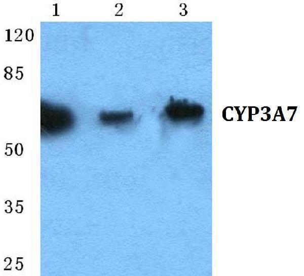Western blot (WB) analysis of CYP3A7 polyclonal antibody at 1:500 dilution
Lane1:HEK293T cell lysate
Lane2:Raw264