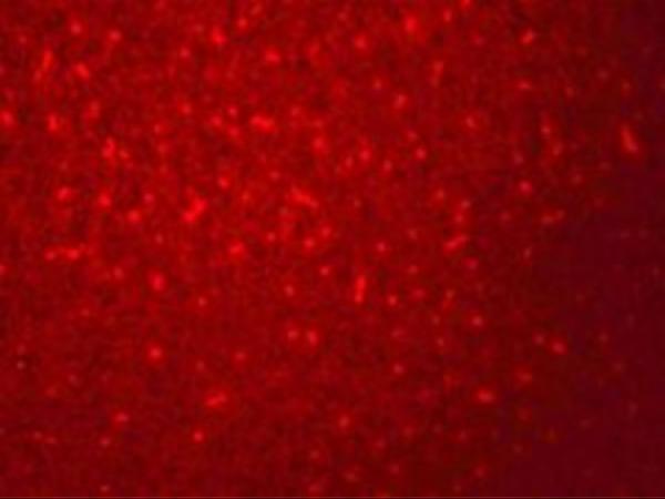 a05419 siva1 primary antibodies if testing 2