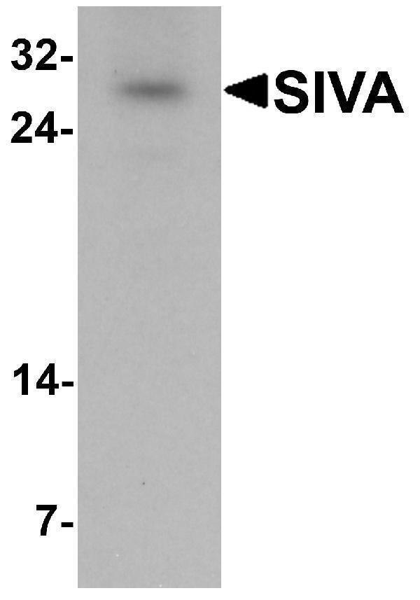 a05419 siva1 primary antibodies wb testing 1