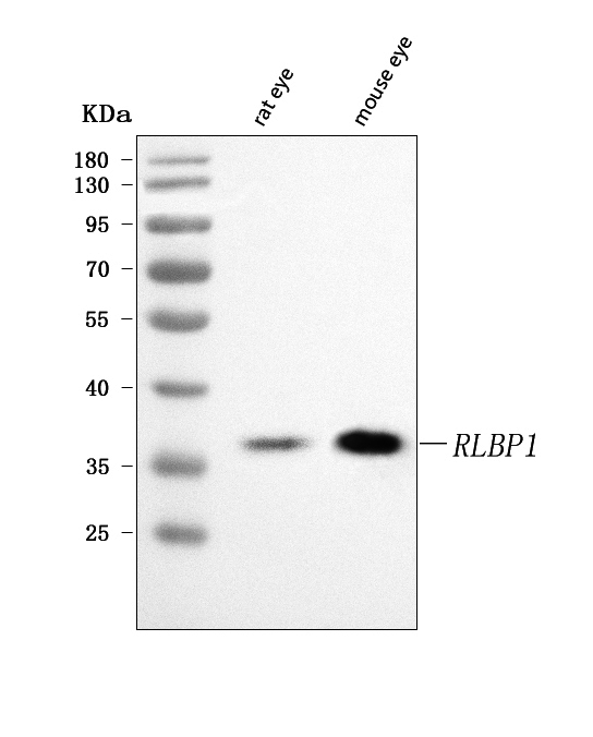 a05421 1 rlbp1 primary antibodies wb testing 1