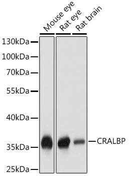 a05421 rlbp1 primary antiboties wb testing 1