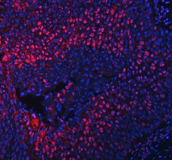 a05428 1 rlim primary antibodies if testing 10