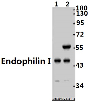 Western blot (WB) analysis of Endophilin I (P84) pAb at 1:500 dilution
Lane1:The Brain tissue lysate of Mouse(10ug)
Lane2:The Brain tissue lysate of Rat(10ug)