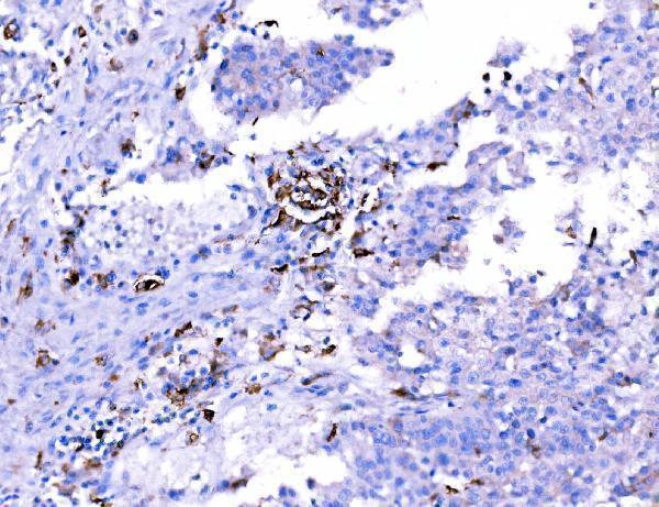  IHC analysis of SH3GL2 using anti-SH3GL2 antibody (A05430-2)