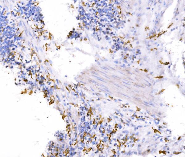  IHC analysis of SH3GL2 using anti-SH3GL2 antibody (A05430-2)