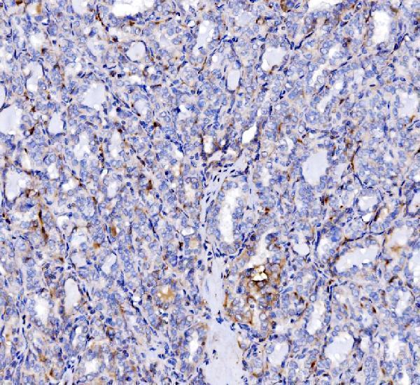 a05430 2 sh3gl2 primary antibodies ihc testing 4