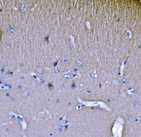 a05430 2 sh3gl2 primary antibodies ihc testing 5