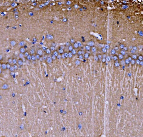 a05430 2 sh3gl2 primary antibodies ihc testing 6