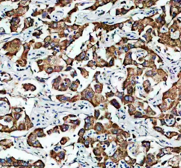 a05431 1 etfb primary antibodies ihc testing 1