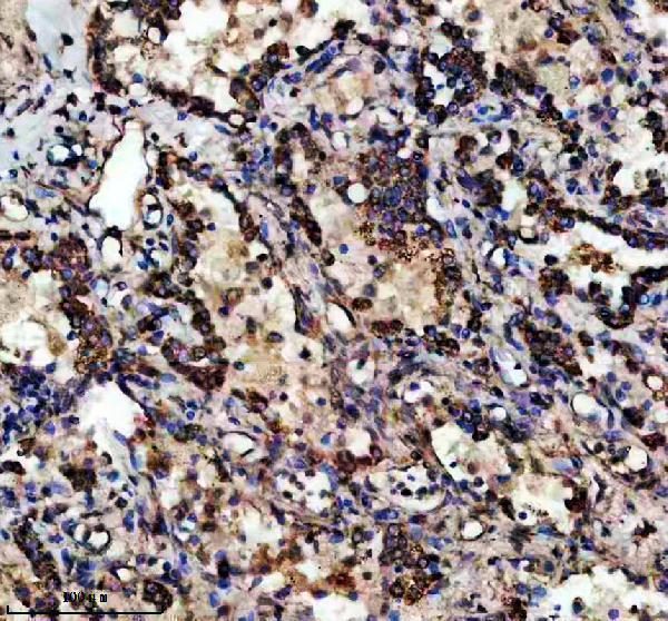 a05431 1 etfb primary antibodies ihc testing 2