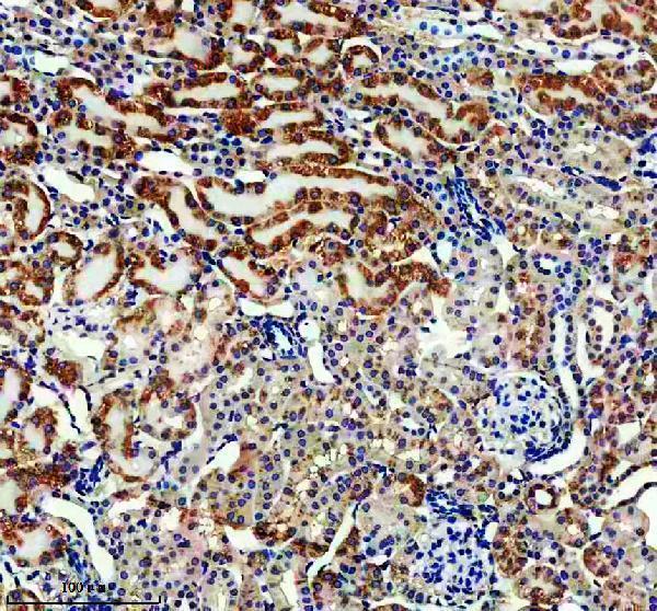 a05431 1 etfb primary antibodies ihc testing 3