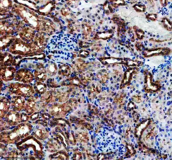 a05431 1 etfb primary antibodies ihc testing 5
