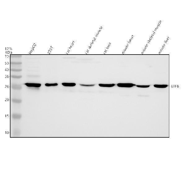 a05431 1 etfb primary antibodies wb testing 1