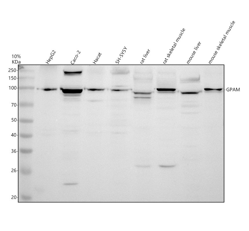Western blot analysis of GPAM using anti-GPAM antibody (A05432-1)