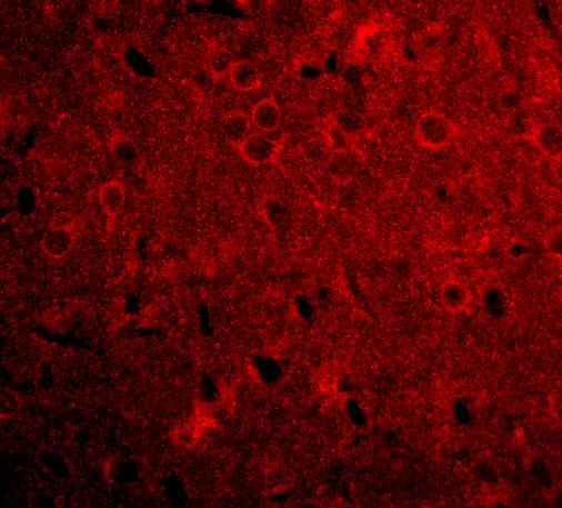 a05432 gpam primary antibodies if testing 3