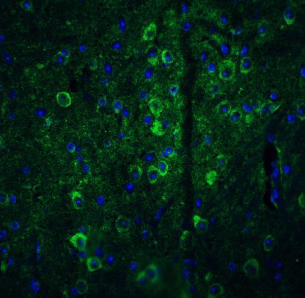 a05432 gpam primary antibodies if testing 5