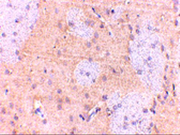 a05432 gpam primary antibodies ihc testing 2