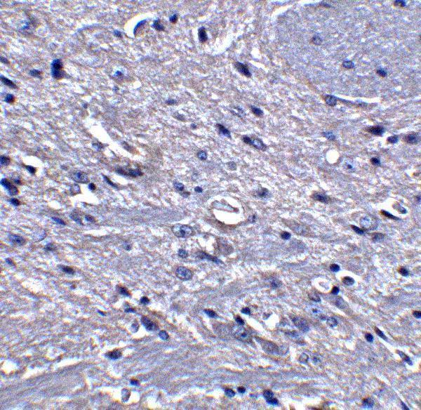 a05432 gpam primary antibodies ihc testing 4