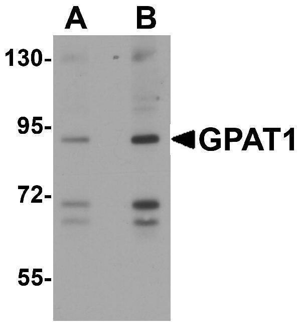 a05432 gpam primary antibodies wb testing 1