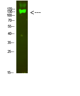Western blotting validation for Anti-Integrin beta ITGB7 Antibody A05433
Western Blot analysis of mouse-heart cells using primary antibody diluted at 1:1000 (4°C overnight)
