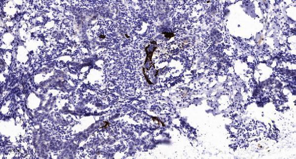 Immunohistochemical analysis of paraffin-embedded human Breast cancer