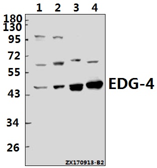 Western blot (WB) analysis of EDG-4 (L310) pAb at 1:1000 dilution
Lane1:Panc1 whole cell lysate(40ug)
Lane2:K562 whole cell lysate(40ug)
Lane3:The Testis tissue lysate of Mouse(40ug)
Lane4:The Testis tissue lysate of Rat(40ug)