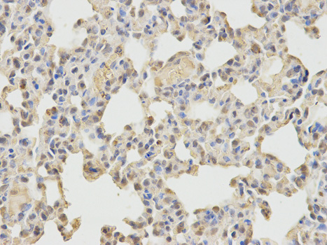 Immunohistochemistry of paraffin-embedded rat brain using N-WASP/WASL antibody  at dilution of 1:100 
