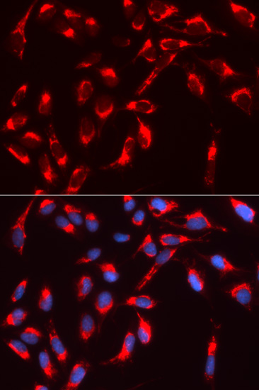 Immunohistochemistry of paraffin-embedded human colon carcinoma using N-WASP/WASL antibody  at dilution of 1:100 