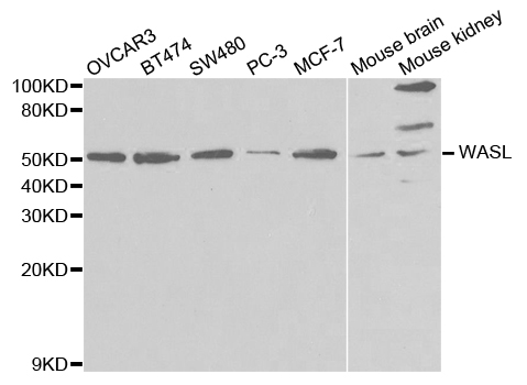 Western blot analysis of extracts of various cell lines, using N-WASP/WASL antibody  at 1:3000 dilution