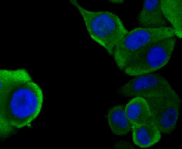 ICC staining WASL in SK-Br-3 cells (green)