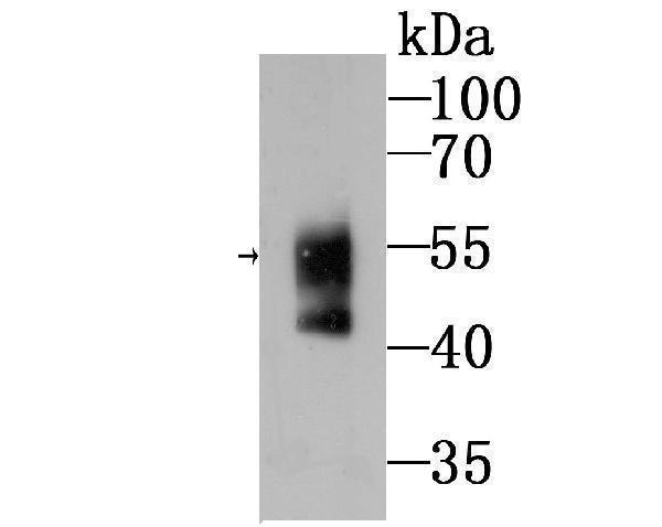 Western blot analysis of WASL on mouse Human serum lysates using anti-Ubiquitin antibody at 1/500 dilution
