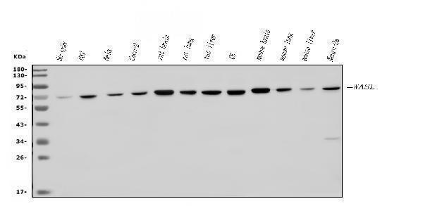  Western blot analysis of N WASP/WASL using anti-N WASP/WASL antibody (A05438-3)
