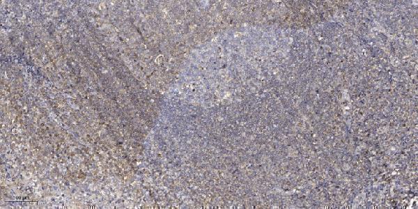 a05439 1 rrn3 primary antibodies ihc testing 1