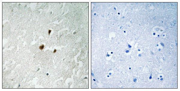 a05439s649 1 rrn3 primary antibodies ihc testing 3