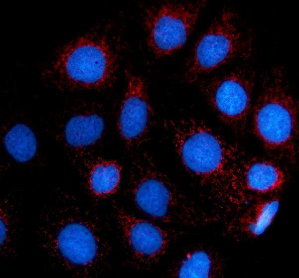 a05441 1 fdx1 primary antibodies if testing 1