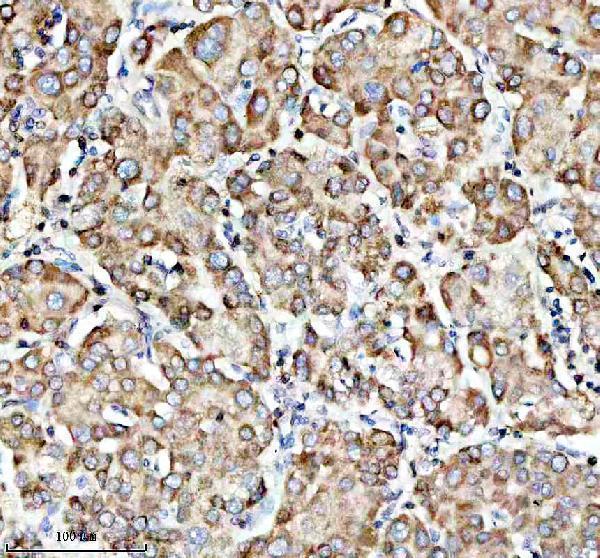  IHC analysis of FDX1 using anti-FDX1 antibody (A05441-1)